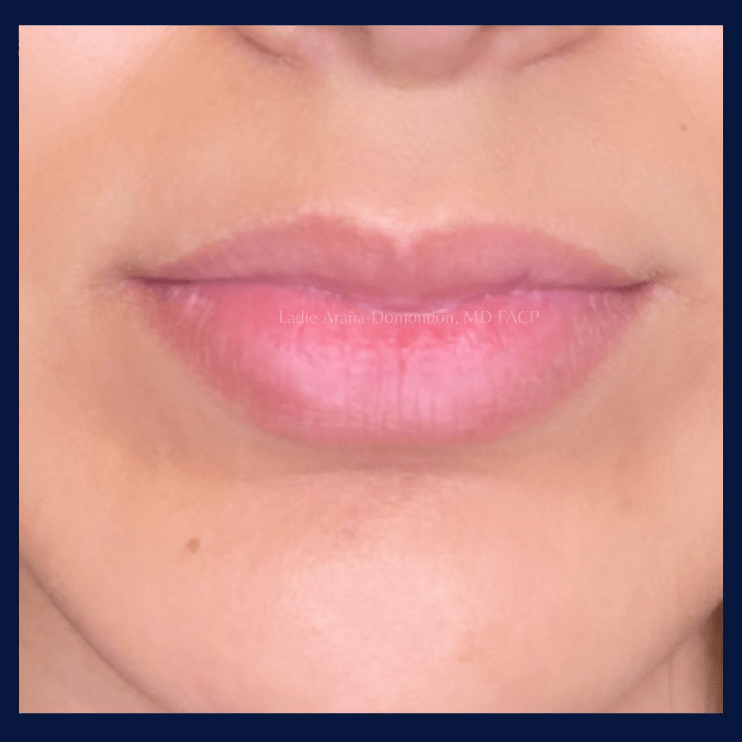 Before Image