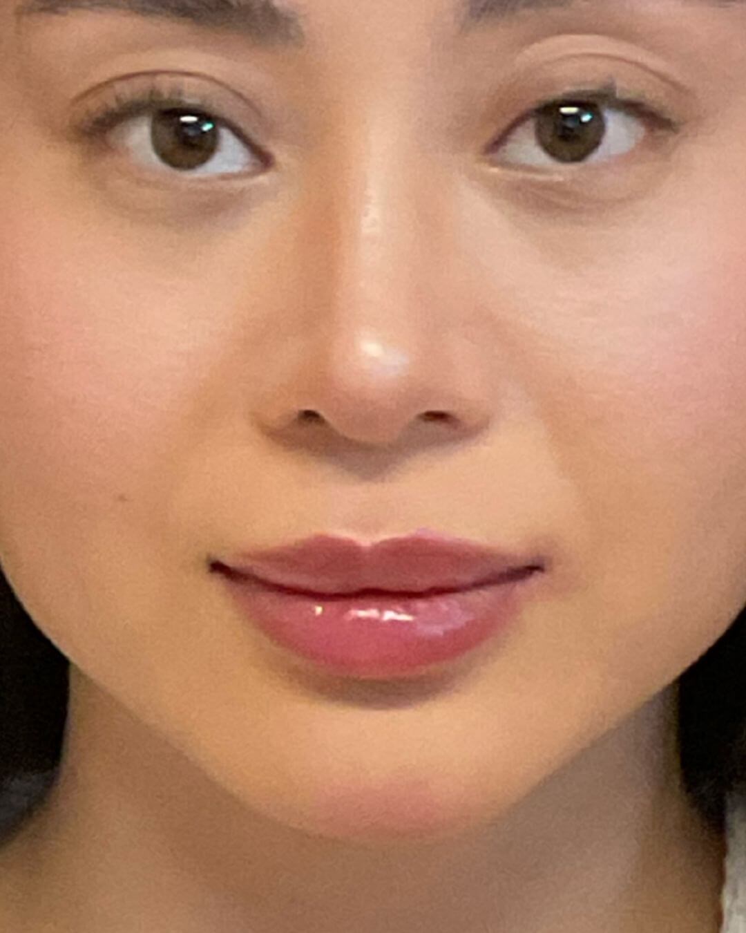 Lip Shaping After